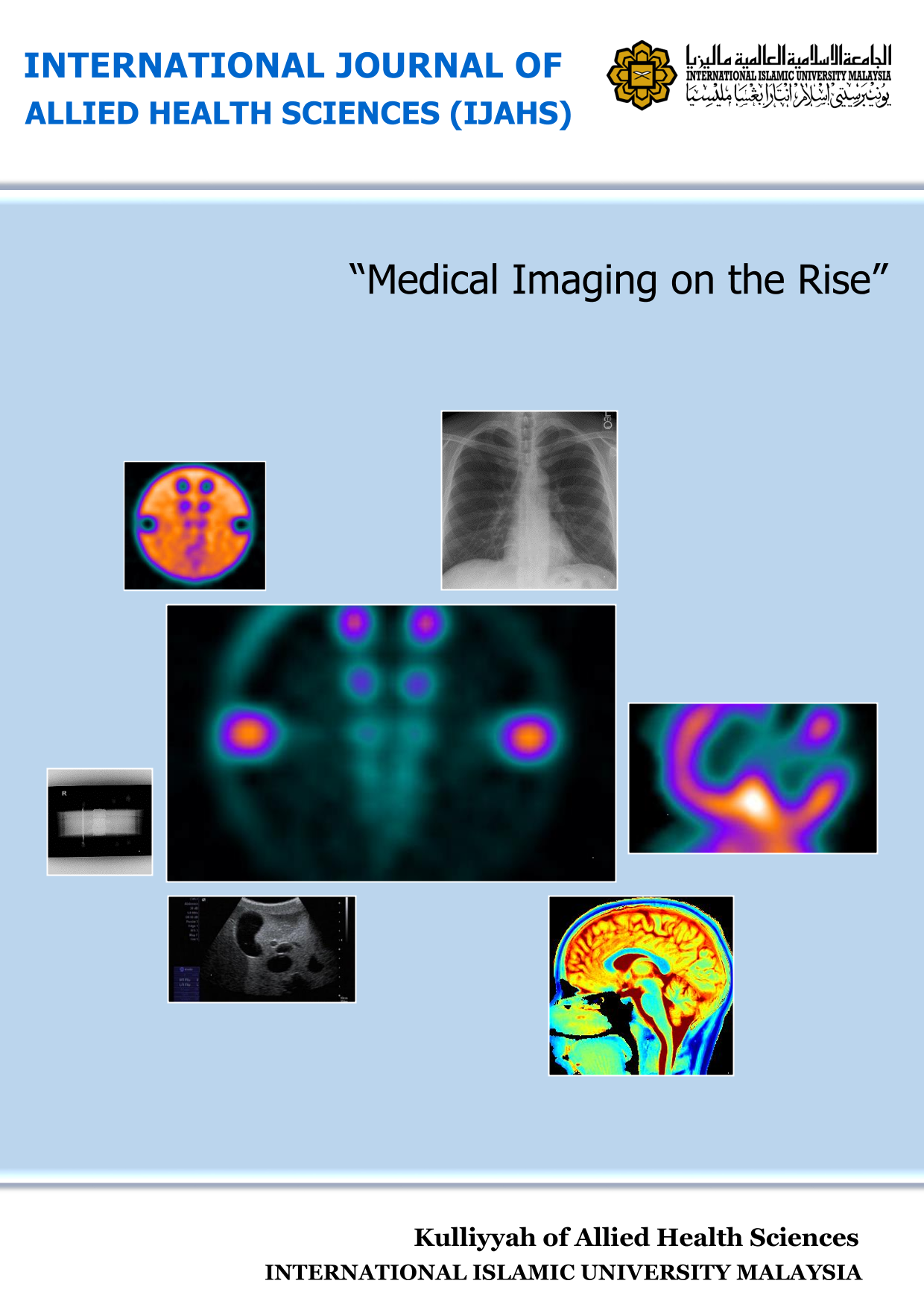 					View Vol. 2 No. 2 (2018): Special Issue: Medical Imaging on the Rise
				