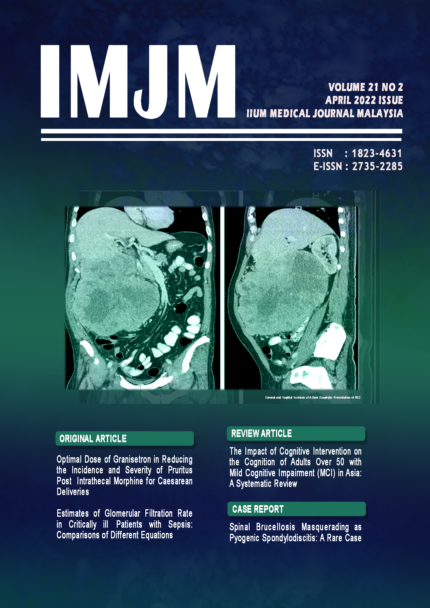 					View Vol. 21 No. 2 (2022): IIUM Medical Journal Malaysia - April 2022
				