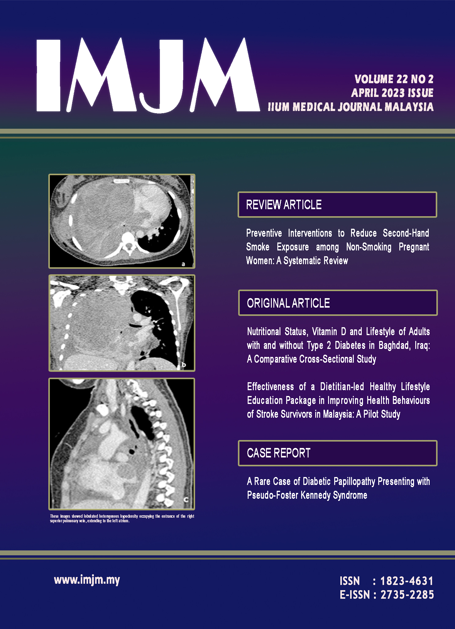 					View Vol. 22 No. 2 (2023): IIUM Medical Journal Malaysia - April 2023
				